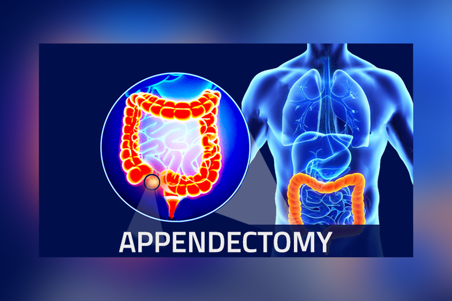 Laparoscopy Pune laparoscopy-pune